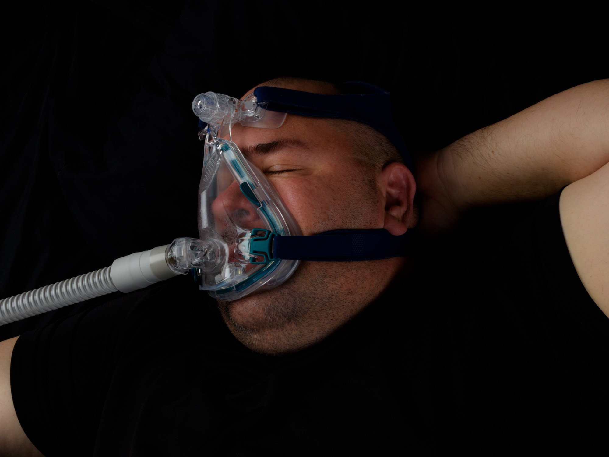 Sindrom Hipoventilasi Obesitas
